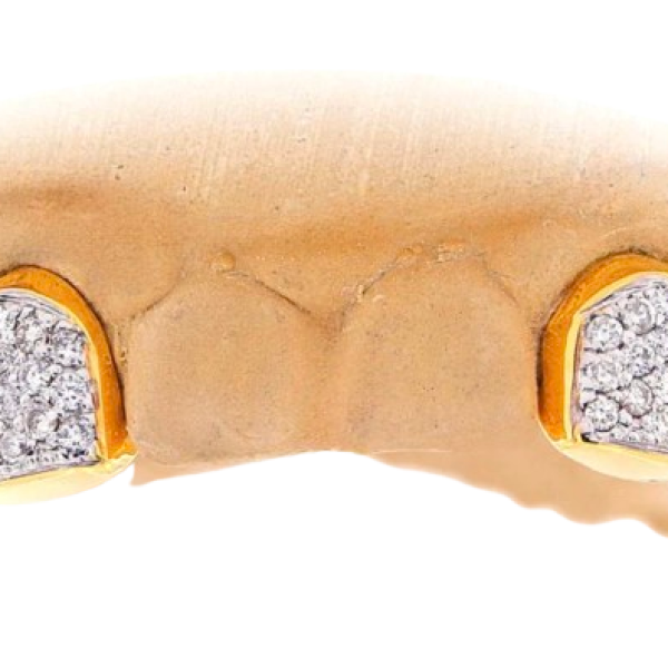 2 PRONG SET CUSTOM COLOR DIAMOND TEETH